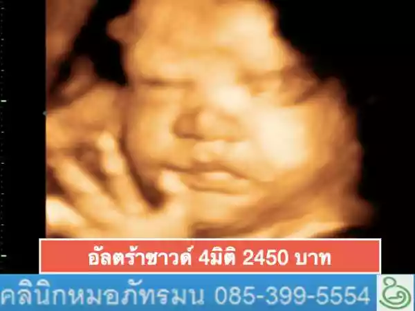ภัทรมนคลินิกเฉพาะทางด้านเวชกรรมสูติ-นรีเวช รูปที่ 4