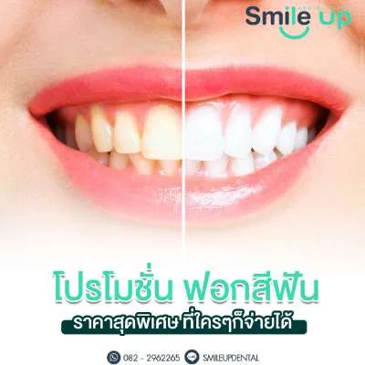 ฟอกสีฟัน Cool Light