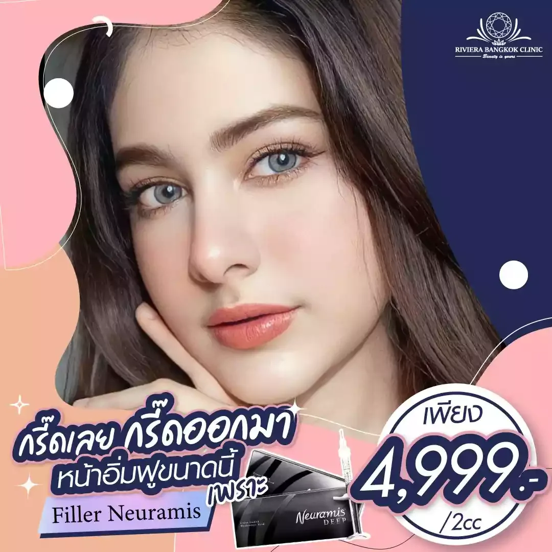 เติมเต็มผิวชั่วคราว ปรับรูปหน้า ร่องลึก